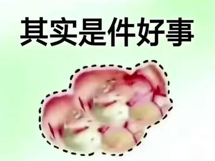 #湿疹#婴儿湿疹#湿疹反复#Dayear皮康胶囊#皮肤