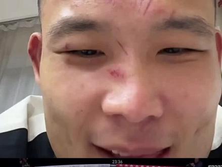 #上热门话题 身为职业运动员,也想为国人争一口气。中国裸拳第一人赵佳奇惨遭阿曼塔耶夫重拳ko!双方实力差距明显,无论是重击质量,拳法密度,实战硬度,重击的精准度对手都更胜一筹。赵佳奇练泰拳出身,打过武林风、昆仑决、MAX泰拳大战等职业赛事。阿曼塔耶夫已经接连击败两位中国选手,下一个会是谁呢?期待有中国选手能够战胜他!!!
#赵佳奇VS阿曼塔耶夫 #赵佳奇惨遭被ko #麦佳园&格斗 #赵佳奇