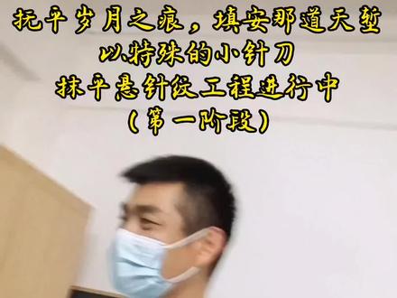 #神奇的小针刀 抚平#悬针纹川字纹 岁月催人老,青春已迟暮;人间有针师,抚平天堑道
