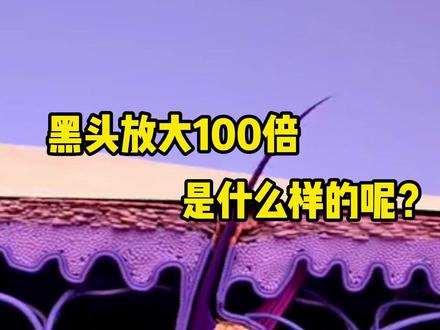 黑头里面有什么呢? #去黑头 #科普 #解压 #微观世界