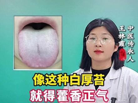 像这种白厚苔,就得藿香正气配附子理中才刮得干净 #抖出健康知识宝藏 #干货分享 #硬核健康科普行动 #我的年度健康盘点