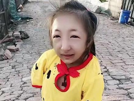 被称为童话中的拇指姑娘年龄20岁身高只有64厘米