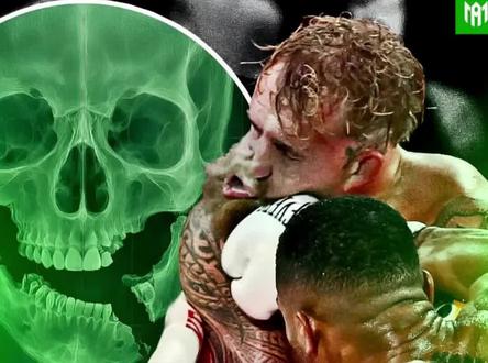 一拳打碎网红下巴骨却坦言这根本算不上胜利