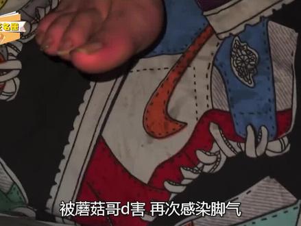 小博:全网最能“忍”室友,因蘑菇哥多次真菌感染仍不离不弃,他为何不换宿舍?