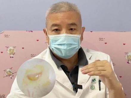 评论区留言回复——烫伤后起水泡,可以戳破吗?#烫伤 #水泡#疤痕 #印象最深的门诊故事 #万粉成长计划