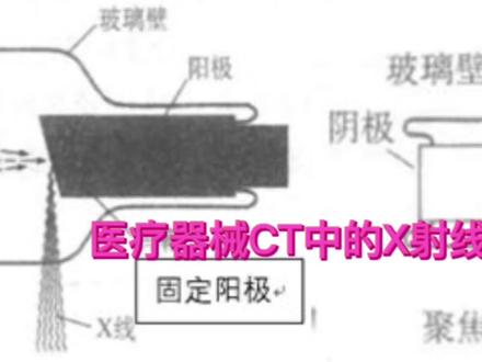 CT检测比以前的胸透先进很多。