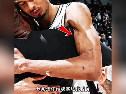 “文班亚马恶意肘击的真相,森林狼这次可能真的惹错人了”#文班亚马 #马刺