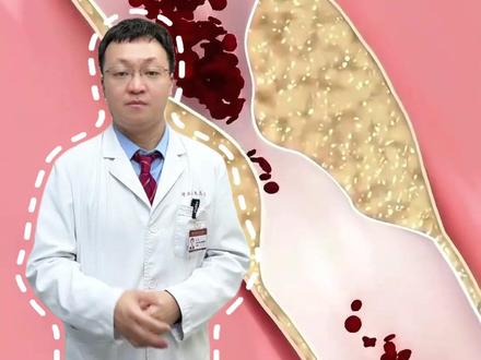 血管越堵头越晕,三味药煮水喝,活血化瘀 祛瘀通络#医学科普 #中医 #中医养生 #抖出健康知识宝藏 #干货分享