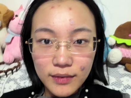 虽然eva治好过我的痘痘 也让我少了很多焦虑 但是它加重了我另一个病情(不是说吃eva让我生了病 但是脱不了关系) 所以在此告诫大家不要轻易吃eva了#抗痘 #eva #油痘肌