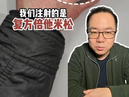 类风湿关节炎 小关节封闭#类风湿 #类风湿关节炎