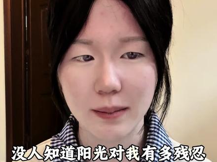 很多人都不理解我的白化病,不就是皮肤白了点吗?头发白了点吗?其实真不是那么回事#白化病女孩 #口播分享自媒体 #正能量#上热门🔥 #上热门抖音小助手