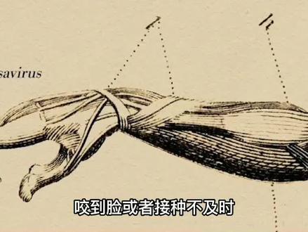 为何狂犬病致死率高?带你了解世界危险病毒!狂犬疫苗不要轻易打 #狂犬病 #最恐怖病毒