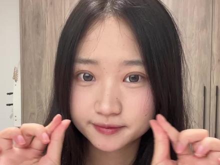 16天的双眼皮分享#全切双眼皮 #日常唠嗑