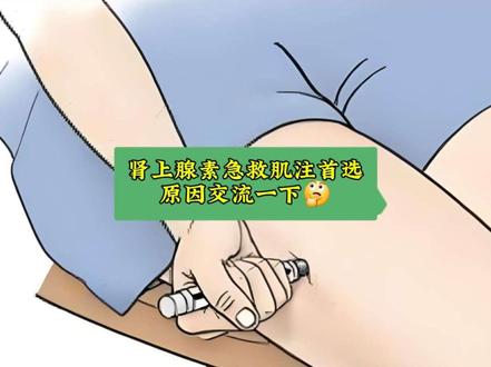 肾上腺素急救肌注首选原因交流一下仅供参考#医学科普 #麻醉医生日常工作#个人观点仅供参考#上热门