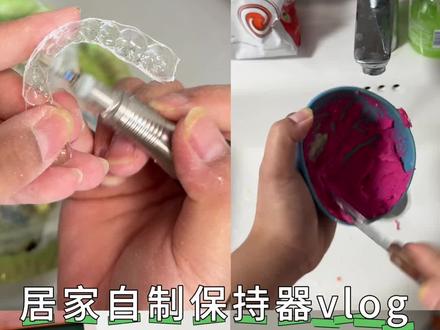 实现保持器自由的第3年!#保持器制作 #正畸 #正畸变美
