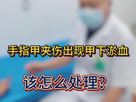 指甲外伤甲下积血处理良策