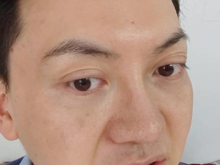 #护肤 #美容仪测评 科施佳红蓝光使用一周后真实情况反馈,无滤镜无美颜#护肤分享