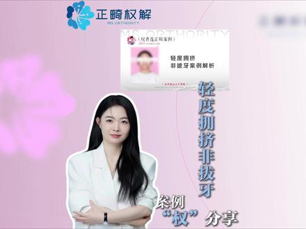 非拔牙案例怎么做?保证短平快,权香莲老师5分钟讲明白! #正畸 #正畸学习 #正畸权解 #正畸权解权香莲