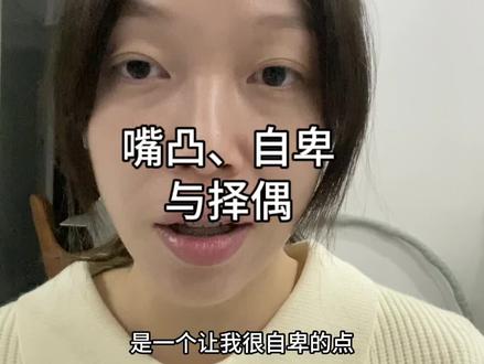 嘴凸、自卑与择偶
我曾经也为嘴凸自卑过,盯着这个缺点不肯放过自己,觉得一切的失败都跟嘴凸有关。直到我意识到自己除了嘴凸还有其它的缺点和优点,人生并不会因为一个人嘴凸就毁灭她的一切,我还可以发扬自己的优点,让闪光点更突出,我还可以赚钱改善自己的嘴凸,我还可以
做很多事情让我的人生变好,若我只盯着嘴凸焦虑,那我这辈子确实可能就毁掉了。客观地讲,嘴凸确实会影响找对象,特别是想找质量
高的对象的时候,对方看外貌可能就刷掉我了,而看脸的工作也不会轮到我,如果很在意,那就想办法矫正。但这是一个长期的过程,我们的生活仍旧要继续,难道在这期间就不社交不见人了不赚钱了吗?所以无论如何都要修炼自己的心态,接受当下,积极行动,等待时机。