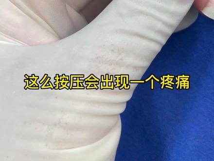 整形医生做减肥塑形,没毛病吧,完全符合专业特色呀~
#专业的事交给专业的人 #医学科普 #修脚大师