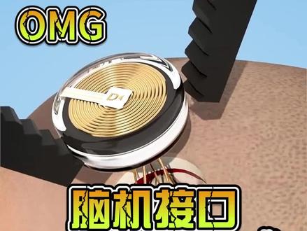 脑机接口:连接大脑与未来的科技革命 #知识分享 #科普一下