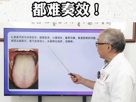 舌苔白腻如雪,参苓白术、二陈都难奏效! #脾胃 #中医 #健康