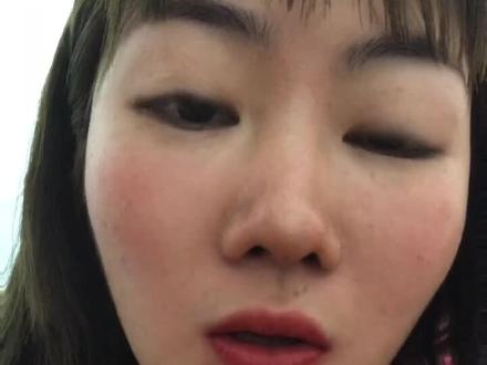 生长因子 了解一下 祝大家好运 希望不要疯长了#上热门