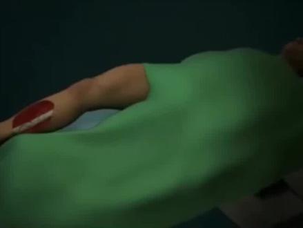 粉碎性骨折如何修复#3d动画演示 #健康科普 #骨科