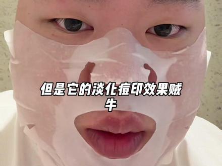 朋友都说自己色号变了,痘印没了!就是这一套 #抗痘 #战痘成功 #痘印