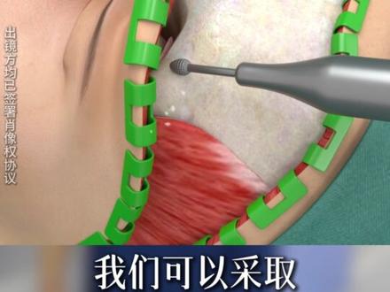 为什么你的高眉骨不仅不高级,还很显凶显老?? #眉骨 #高眉骨 #眉骨降低 #眉弓 #高眉骨