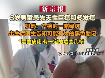 3岁男童患先天性巨痣和多发痣 妈妈:产检时一路绿灯 出生后医生告知可能有大的黑色胎记 “是兽皮痣 有一定的癌变几率”@美侠小豆❤️(琪宝妈妈要努力)