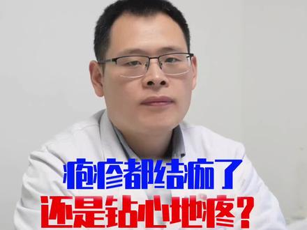 疱疹都结痂了,还是钻心地疼?#带状疱疹后神经痛 #医学科普 #健康科普