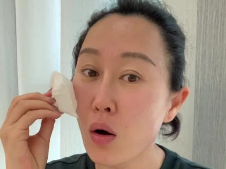 蜂巢皮秒祛斑效果好吗?斑到底怎么搞?
#蜂巢皮秒 #祛斑 #斑 #变美 #黄褐斑