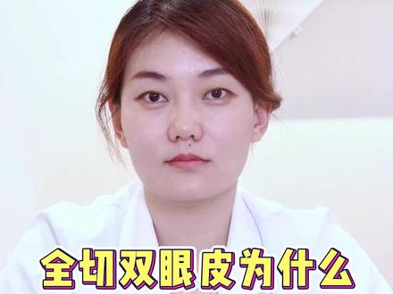 全切双眼皮为什么会出现分叉?#医学科普#双眼皮 #眼修复 #重睑