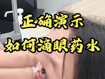 教你如何正确滴眼药水#眼药水的正确滴法 #眼药水别直接滴眼球上 #眼药水滴多了对眼有伤害吗 #眼科医生曾雯