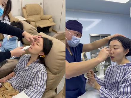 Do鼻1到7天记录#do鼻#整形#变美