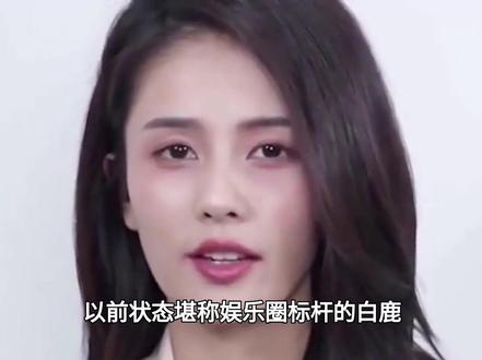网友在高铁站偶遇白鹿憔悴疲惫,腿脚不便一瘸一拐惹心疼#白鹿