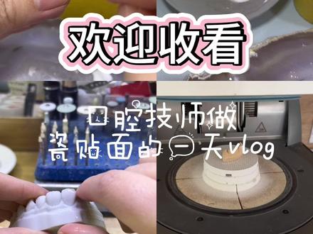 #真实生活分享计划 今天做一颗纯手工局部贴面,门齿有缝的,还有局部缺失的看过来,过来了解一下吧,医生大大们,快来找我做贴面呀🫶🏻🦷🦷#口腔技师 #口腔医学技术 #牙医日常 #vlog十亿流量扶持计划