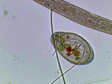 单细胞生物这么能吃吗?#细胞 #生命 #微生物#显微镜 #趣味科普