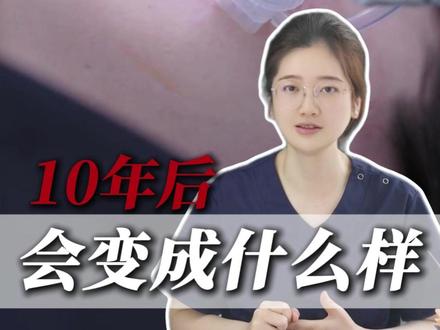 长期打水光针的后果…你真的承受得了吗? #水光针 #变美 #水光 #do脸 #皮肤管理 #补水水光 #美白水光 #广州皮肤管理 #广州水光 #水光针科普