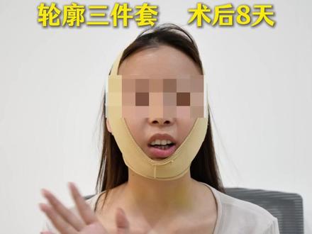 磨骨三件套术后第8天,现在状态怎么样啦? #磨骨三件套 #磨骨改脸型 #磨骨术后 #脸型 #下颌角