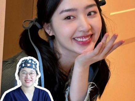 邓恩熙这种成人露龈笑 可以靠矫正解决吗? 上颌骨垂直向发育过度,矫正很难改善
她的牙齿角度也是比较直的,几乎是直在这里。并没有出现笑起来牙齿翘出来这个问题,牙的位置比较好,她的牙槽骨也是直直的这样露出来。这种问题呢可能就是出现了上颌骨发育过度的情况,就是上颌骨比较高。
轻度露龈笑,打骨钉压低上前牙
对于这种上颌骨比较高的情况,我们是没法通过矫正来做内收的。对于一些不太严重的,比如你的露牙龈大概两三毫米。这种我们是可以考虑打打支抗钉,然后去做上前牙的压低,也可以缓解一下露龈笑的问题。
重度露龈笑,正颌手术
那对于这种露的比较多的,我们是没办法通过支抗钉来达到这么一个限度,可能只能通过正颌手术的方法,先去做矫正矫正一段时间之后,把这块骨头上抬,上抬了之后,可以解决这个露龈笑的问题。