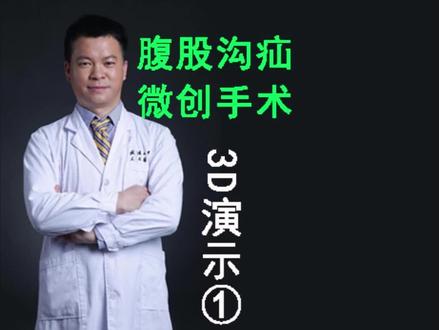 腹股沟疝微创手术3D演示①