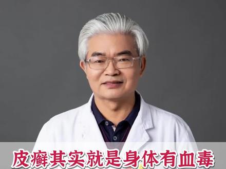 皮癣其实就是身体有血毒 #中医 #抖出健康知识宝藏 #科普