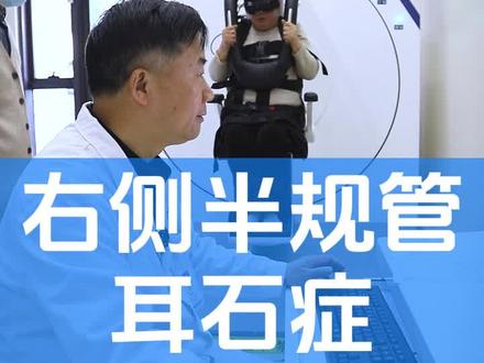 #耳石症 #耳石症复位 #耳石症科普 #耳石症眩晕 #席刚明