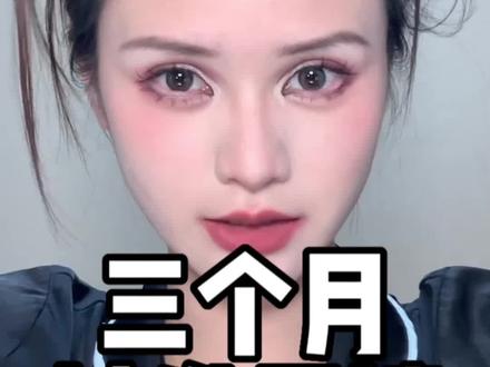 植发三个月啦!不愿再做阿哥#拯救发际线