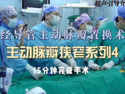 手术室真实场景,15分钟完成心脏瓣膜置换术!