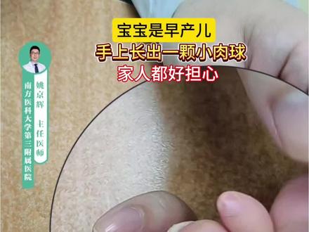 宝宝是早产儿,手手多长了一个小肉球,是最简单的多指! #我的年度健康盘点 #抖出健康知识宝藏 #谷雨更懂东方面孔 #多指畸形