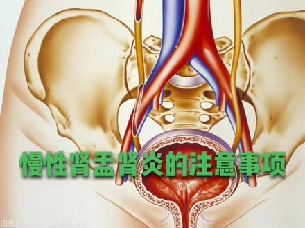 慢性肾盂肾炎的注意事项#问答c计划 #我是抖音vlogge #用乐事搞笑上电视 @南方健康 @头条健康