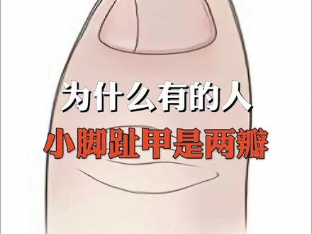 你的小脚趾甲是两瓣的吗?#寻找1000位科普达人 #冷知识 #涨知识